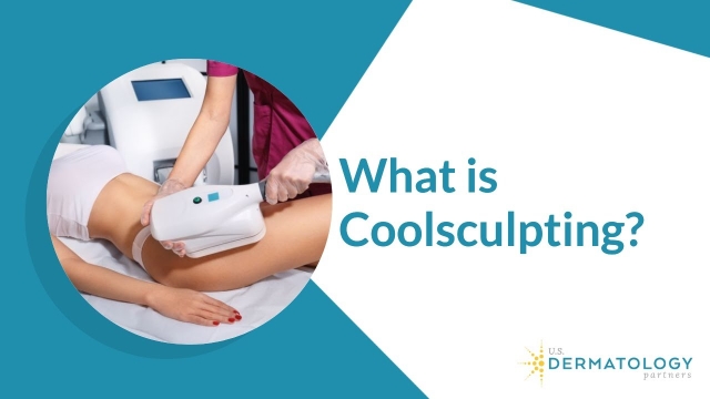 Frosting Away Fat: Exploring the Magic of Cool Sculpting