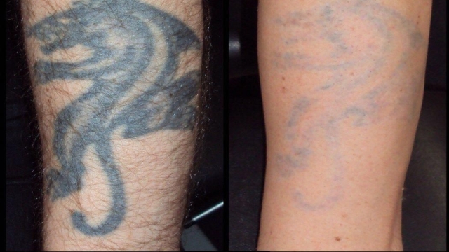 Tattoo Fade Cream – How Effective Is This Kind Of?