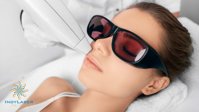 The Ultimate Guide to Effortless Hair-Free Skin: Laser Hair Removal 101