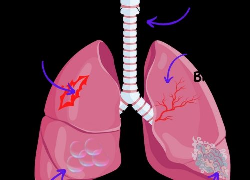 Breath of Innovation: Exploring the Future of Inhalation Devices